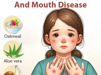 Home remedies for hand foot and mouth disease