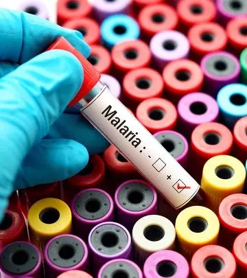 मलेरिया के कारण, लक्षण और घरेलू इलाज – Malaria Symptoms and Home Remedies in Hindi