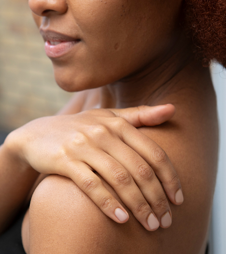 Stretch Marks On The Shoulders: Why You Get Them And How To Prevent Them