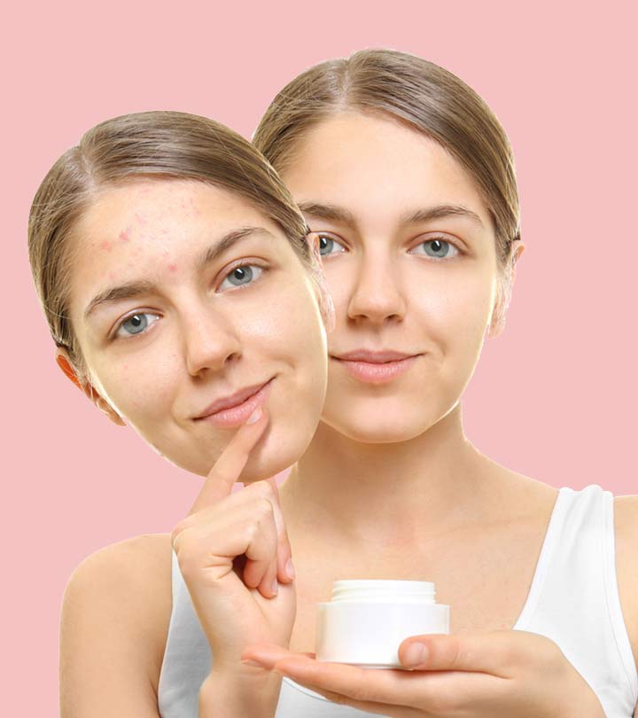 14 Best Drugstore Acne Treatment Products Of 2023