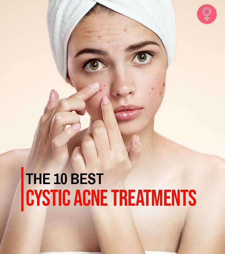 10 Best Cystic Acne Treatments That Work Like A Charm – 2023