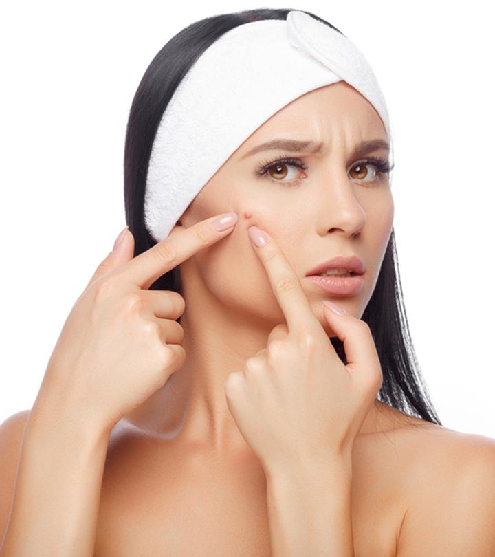 The Top 10 Aloe Vera Gels To Treat Acne In 2023