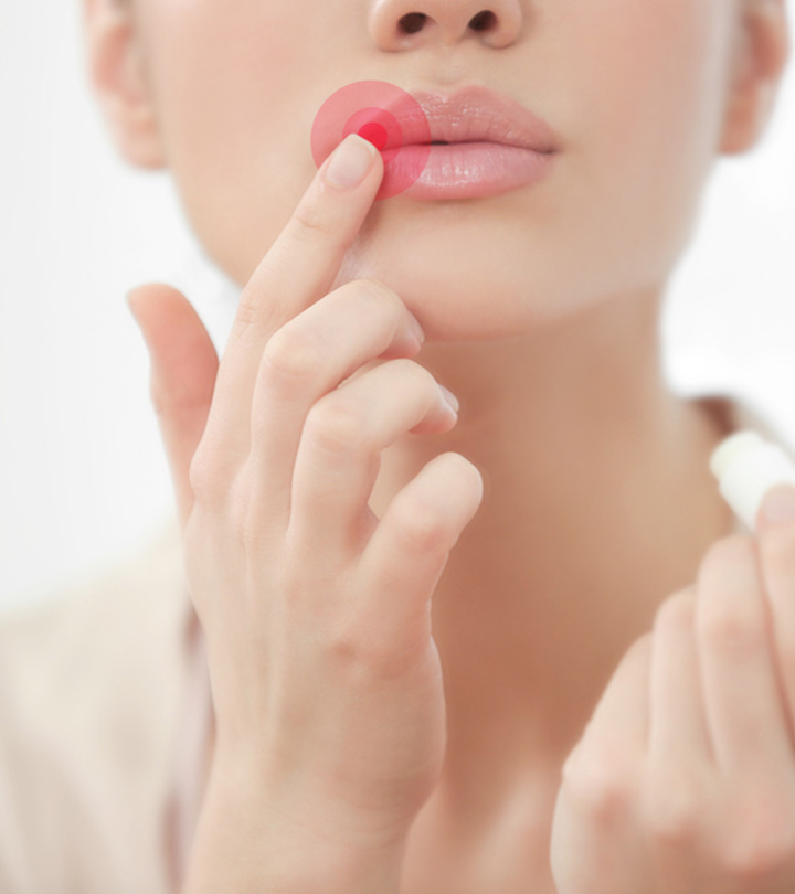 13 Best Lip Balms For Cold Sores (2023) Treatment