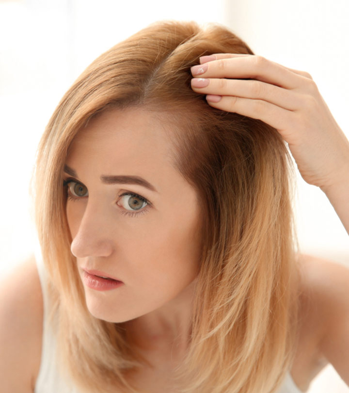 Lupus Hair Loss: Causes, Types, And Treatment