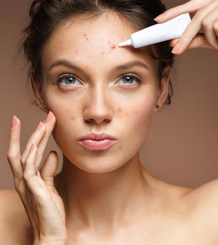 The 15 Best Acne Treatments That Work Effectively – 2023