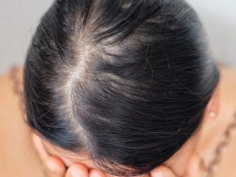 Diffuse Hair Loss (Alopecia): Causes, Signs, And Treatments