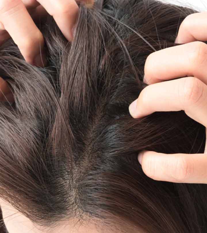 DOES ITCHY SCALP MEAN MY HAIR IS GROWING? – Naturalicious