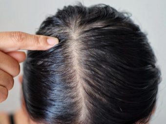 How Do You Treat A Dry Scalp And Oily Hair?