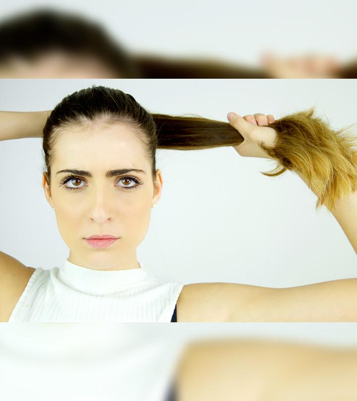 Woman With Traumatic Alopecia Woman With Traumatic Alopecia