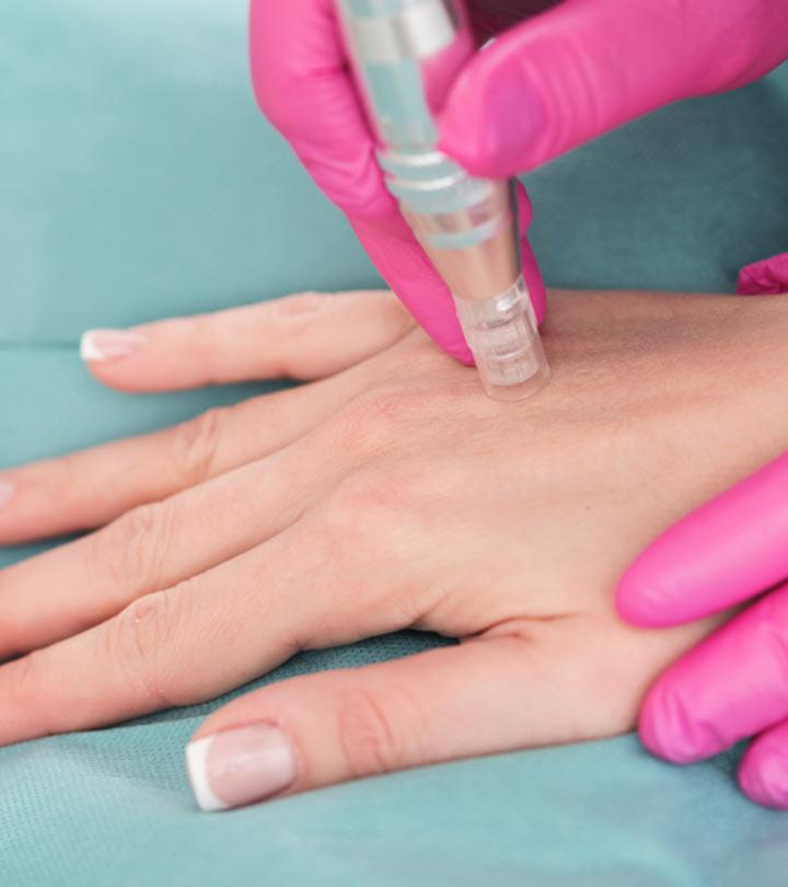 13 Best Eczema Skin Care Products To Keep Flare-Ups At Bay – 2023