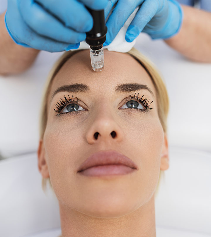 Microneedling Aftercare: Dos & Don’ts, Side Effects, & Treatment