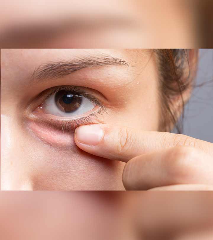 9 Foods That May Cause Your Eyes To Get Puffy