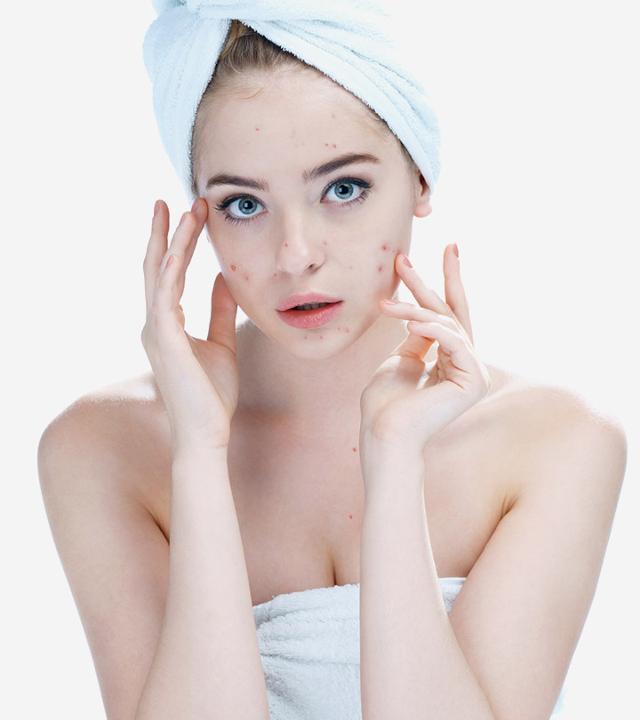 Zinc For Acne Scars & Spots: Treatments, Benefits, Uses & Risks