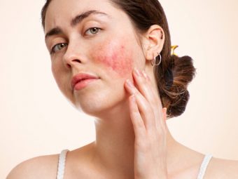 Skin Inflammation: Causes, Symptoms, Diagnosis, And Treatment