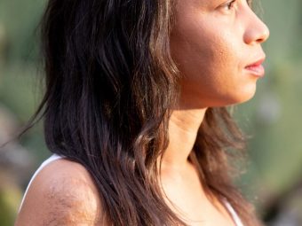 Burn Scars Treatment: 11 Cosmetic Procedures & 3 Home Remedies