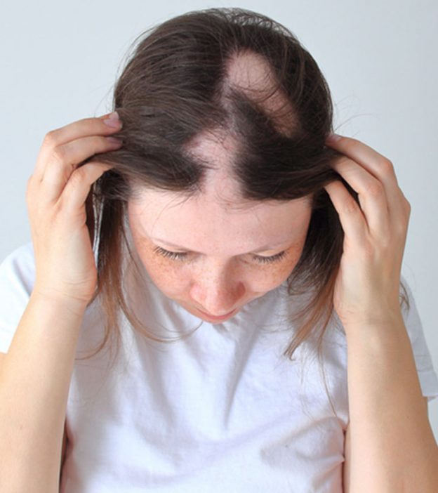 Trichotillomania Hair Regrowth And Treatment