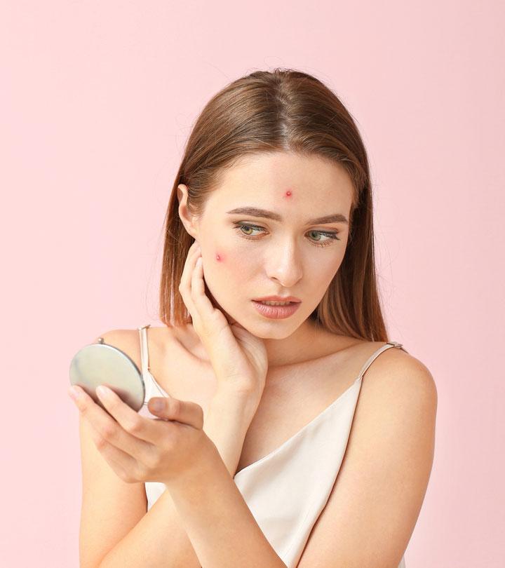 Risks Of Birth Control Pills For Acne Treatment