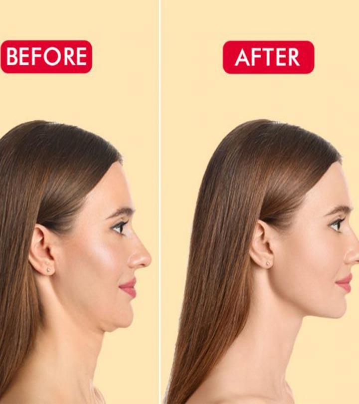 How to Remove Neck and Chest Wrinkles Naturally with this Face Yoga Workout