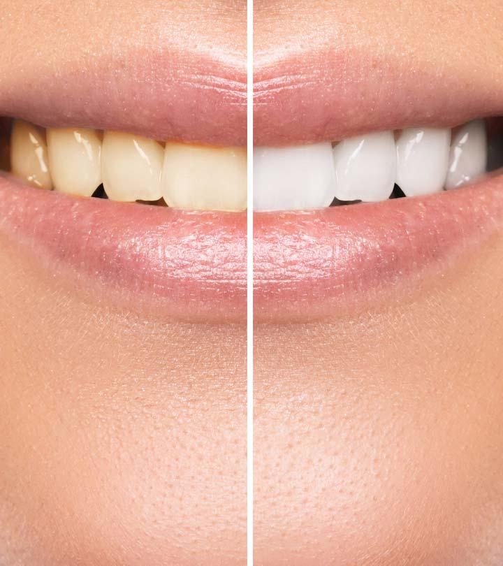 11 Habits That Are Staining Your Teeth