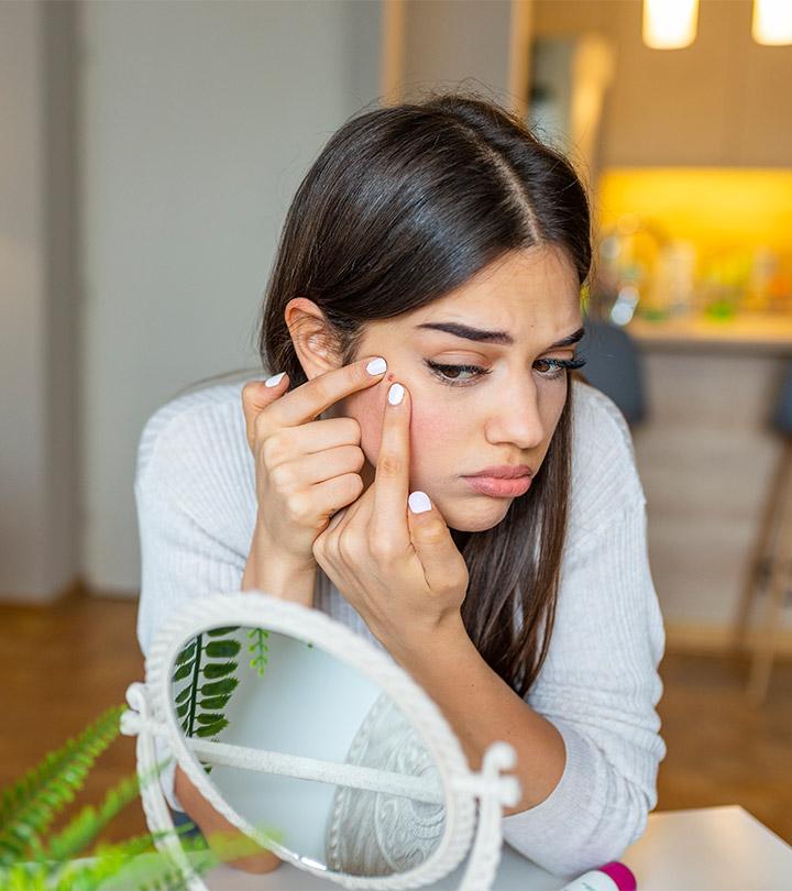 Struggling With Hormonal Acne? Here Is A List Of Foods To Eat And Foods To Avoid