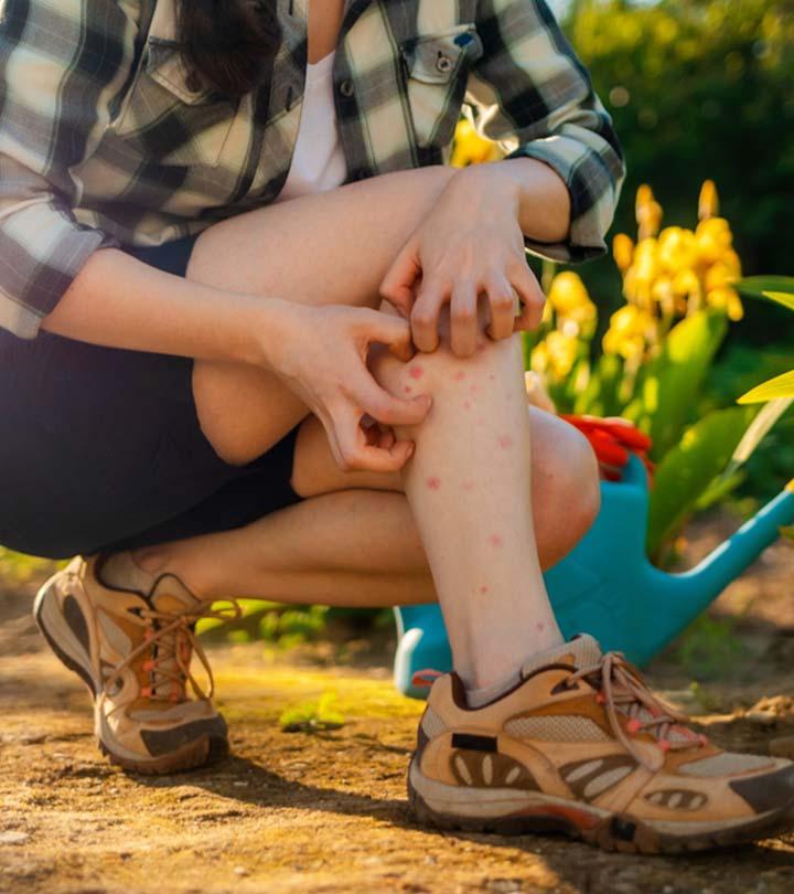 11 Plants That Can Give You A Rash