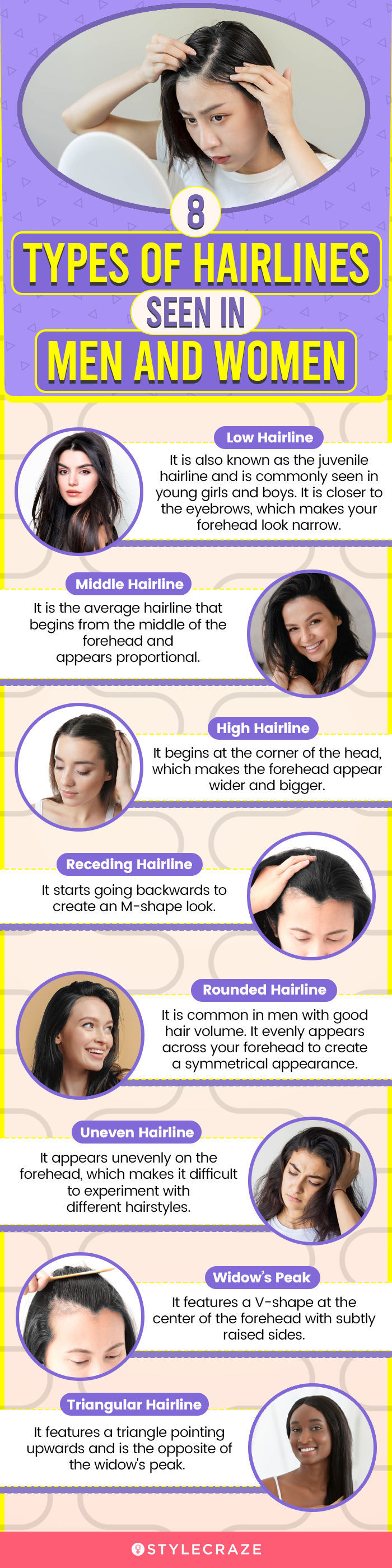 Hairlines Types For Women