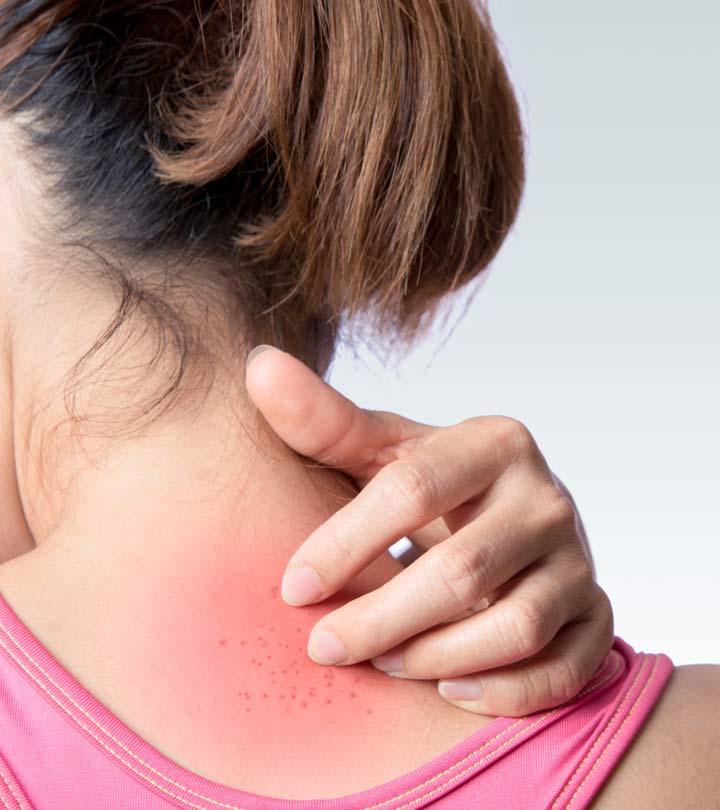 HIV Skin Rashes: Symptoms, Causes, And Treatment Options