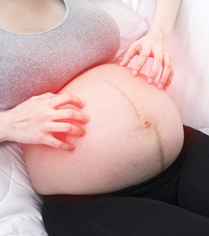 9 Types Of Pregnancy Rash, Causes, Home Remedies, & Treatment