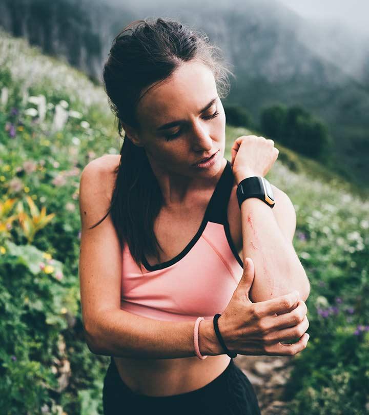 A Women With Scrapes And Abrasions