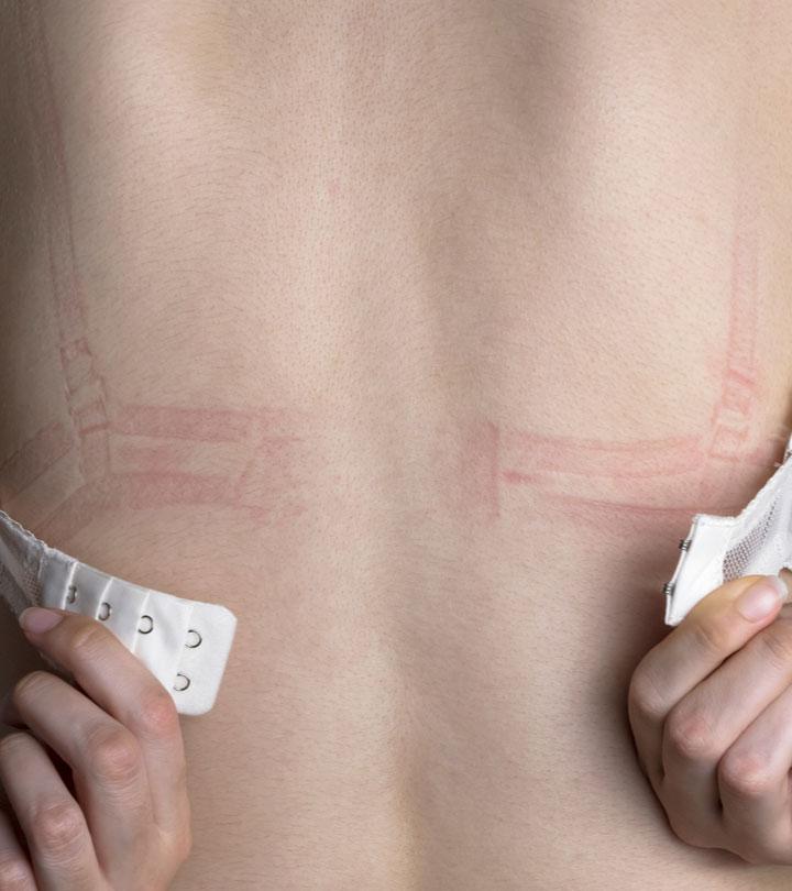 4 Things That Happen To Your Body If You Wear A Misfit Bra