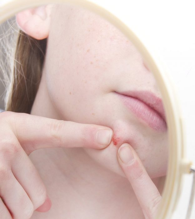 Dermatillomania: All You Need To Know About Skin Picking Disorder