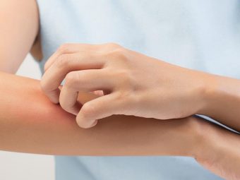 Skin Induration: Symptoms, Causes, And Treatments
