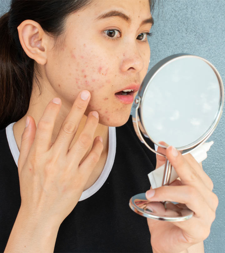 10 Regular Habits That Are Damaging Your Skin In Your 20s