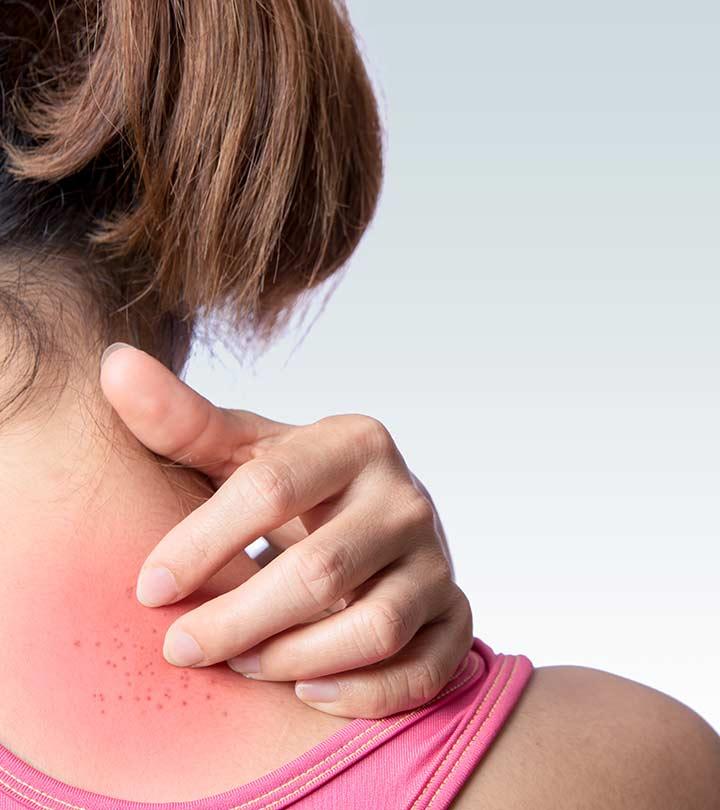 Rash Under Breast: Causes, Treatment, and Prevention