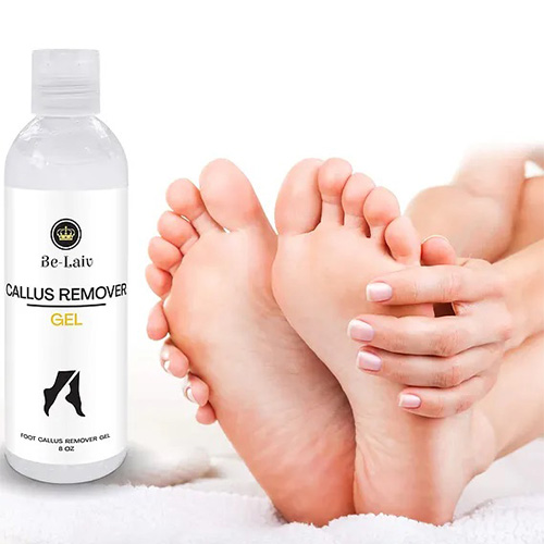 Professional Best Callus Remover Gel for Feet and Foot Pumice Stone  Scrubber Kit Remove Hard Skins Heels and Tough Callouses from feet Quickly  and