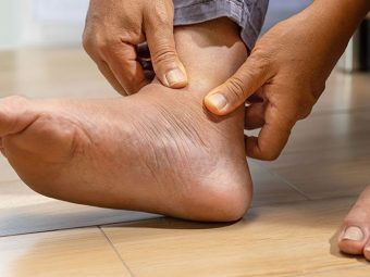 6 Methods To Relieve Swollen Feet