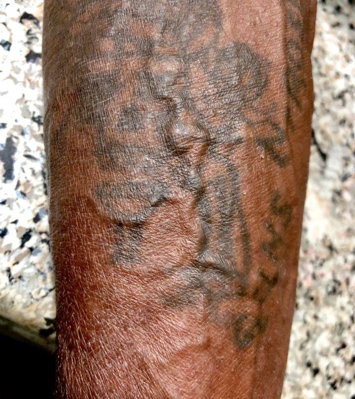 Can You Tattoo Over Varicose Veins? What You Need To Know