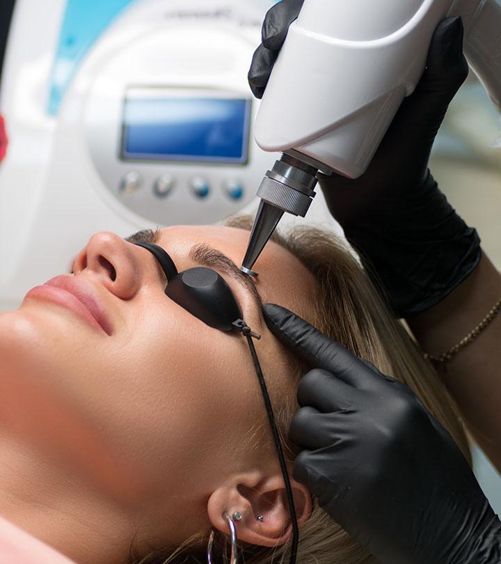 A woman is undergoing the eyebrow tattoo removal process A woman is undergoing the eyebrow tattoo removal process