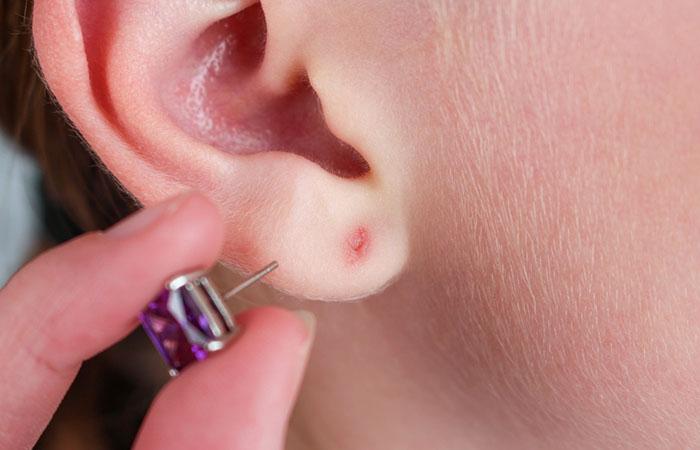 Infected Ear Piercing: What It Looks Like, Signs, And Treatment