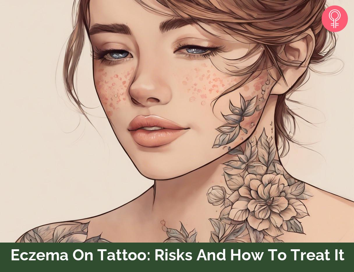 Eczema On Tattoo Risks And How To Treat It